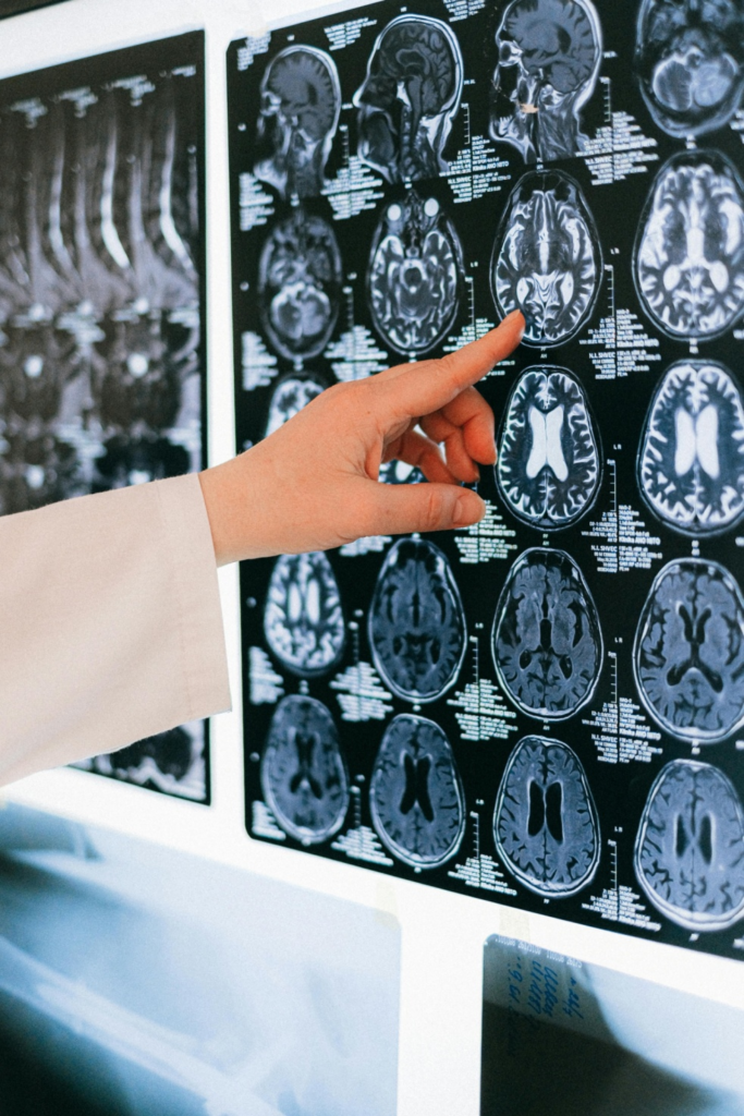 A doctor examining a brain scan