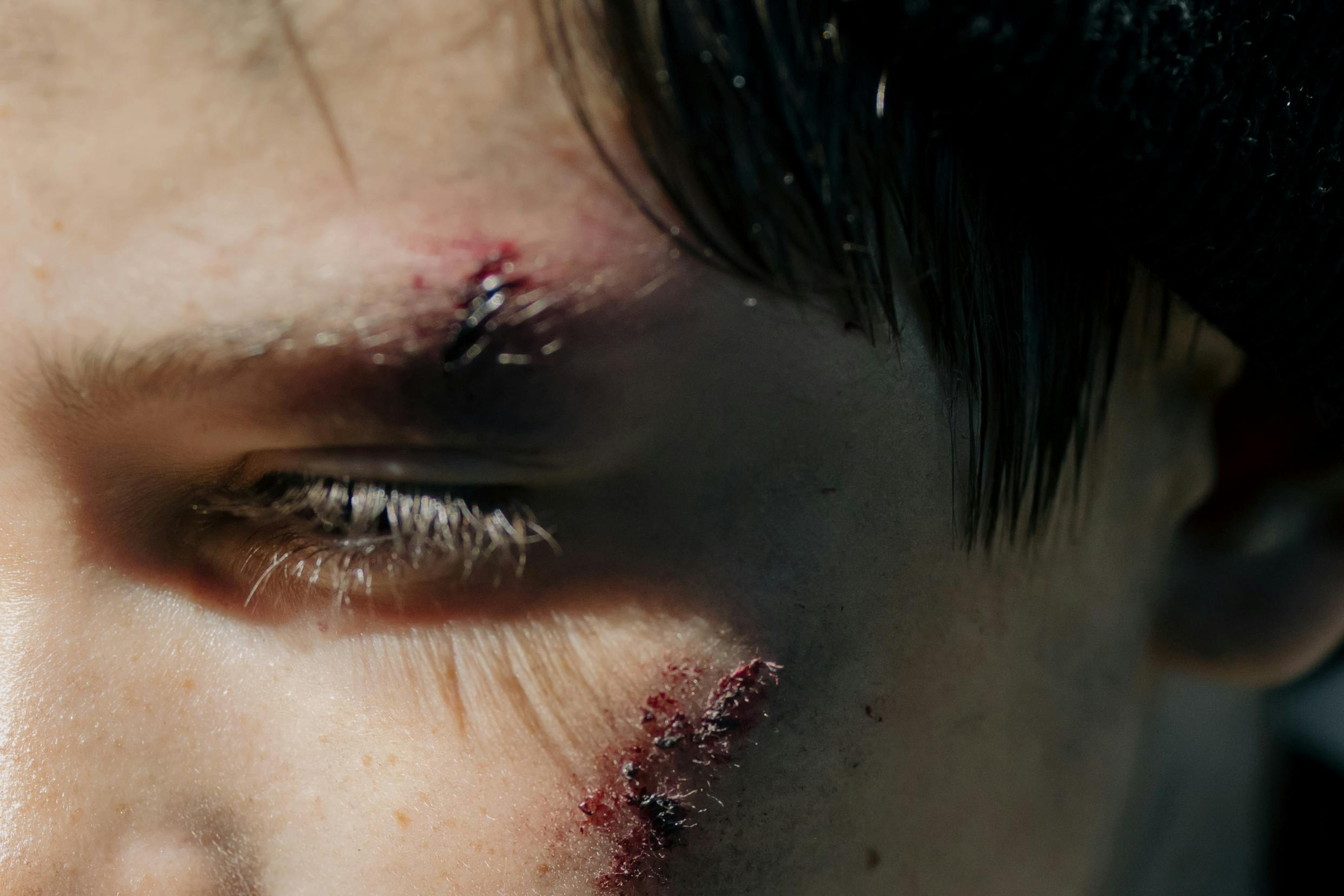 Close-up of a bruised face